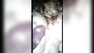 The Deceased's Liver And Eyes Were Removed. Video