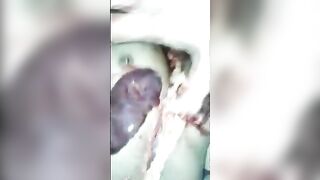 The Deceased's Liver And Eyes Were Removed. Video