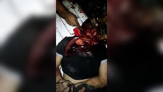 Failed Attempt To Behead A Tied Man 