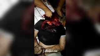 Failed Attempt To Behead A Tied Man 