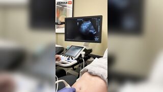 Woman Discovers She's Pregnant During School Lab Class - Video