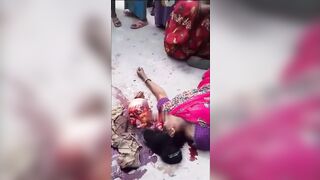 A Woman's Skull Was Ejected From Her Skin In An Accident. India "