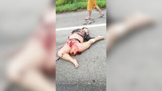 Motorcyclist's Body Torn In Half