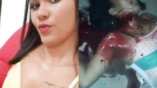 Brazilian Girl Gets Her Neck Slit By Her Husband 