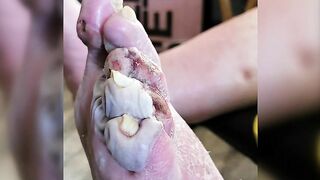 Death, Disease, Injury, Healing, BDSM #8 (Collection) TheYN