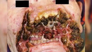 Death, Disease, Injury, Healing, BDSM #8 (Collection) TheYN