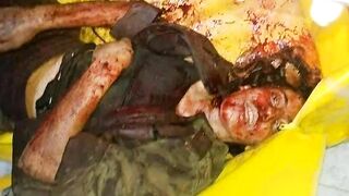 Death, Disease, Injury, Healing, BDSM #8 (Collection) TheYN