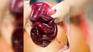 Death, Disease, Injury, Healing, BDSM #8 (Collection) TheYN