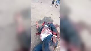 Man Dies After Being Shot In Head By Fulani Herdsmen 