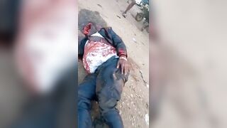 Man Dies After Being Shot In Head By Fulani Herdsmen 