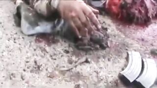 IED Blast Splits Soldier In Half 