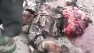 IED Blast Splits Soldier In Half 