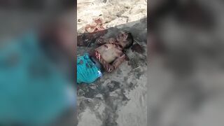 Man Brutally Ends His Life With Machete 