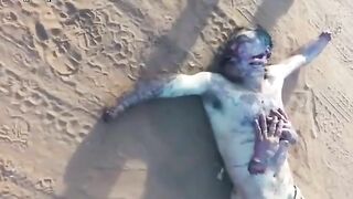 Man With Chopped Face And Hands Dies 