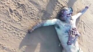 Man With Chopped Face And Hands Dies 