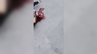 Man Dies After Being Shot In Head With Revolver 