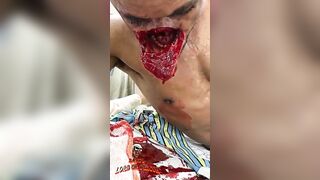 Man Gets Fucked After Having His Face Cut Off 