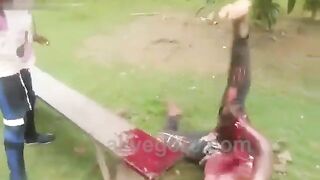 Man's Hand Chopped Off 