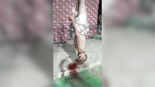 Man Falls To The Ground Bleeding 