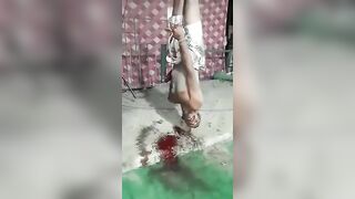 Man Falls To The Ground Bleeding 