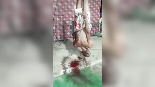 Man Falls To The Ground Bleeding 