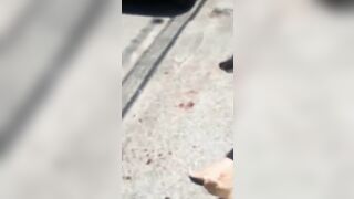 Man Stabs Girlfriend In Throat After Stabbing Him 
