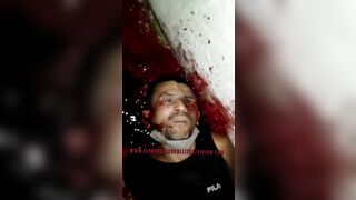 Man Killed And Loses Eye By Killer 