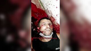 Man Killed And Loses Eye By Killer 