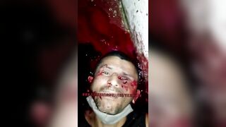 Man Killed And Loses Eye By Killer 