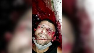Man Killed And Loses Eye By Killer 