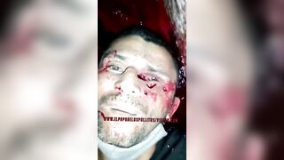Man Killed And Loses Eye By Killer 
