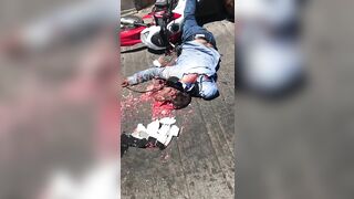 Motorcyclist's Head Crushed By Helmet 