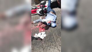 Motorcyclist's Head Crushed By Helmet 