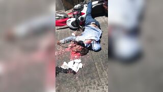 Motorcyclist's Head Crushed By Helmet 