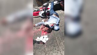 Motorcyclist's Head Crushed By Helmet 