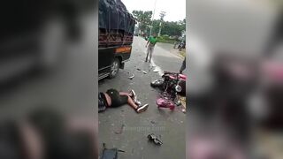 Two People On A Scooter Died In The Accident. A Man Was Scalped 