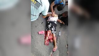Woman Breaks Leg 