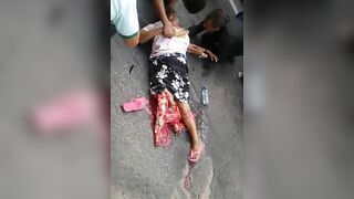 Woman Breaks Leg 