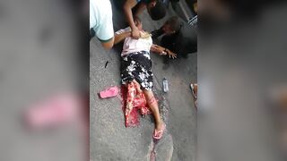 Woman Breaks Leg 