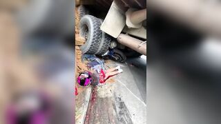 Woman's Body Accidentally Mutilated 