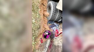 Woman's Body Accidentally Mutilated 