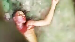 Young Man Stabbed 