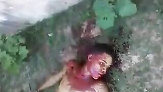 Young Man Stabbed 