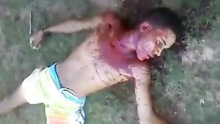 Young Man Stabbed 