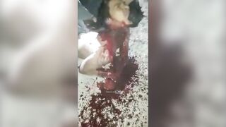 The Young Man Was Beheaded, His Head Was Chopped Off 