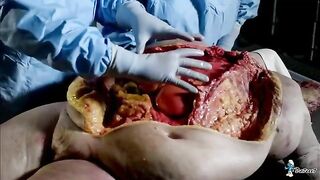 [Full Video] Sexy Redhead Performs Autopsy On Fat Woman