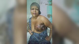 Brazilian Woman With Severe Breast Cancer Seeks Help