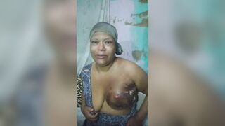 Brazilian Woman With Severe Breast Cancer Seeks Help