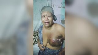 Brazilian Woman With Severe Breast Cancer Seeks Help