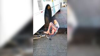 Shit, The Victim's Leg Was Broken.